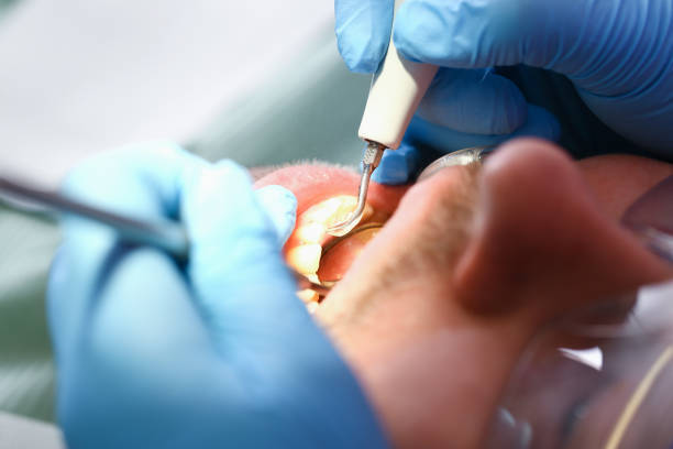 Best Broken or Chipped Tooth Repair in Madison, NC