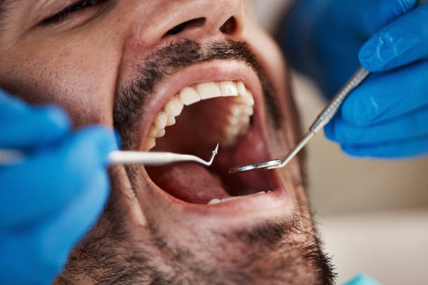 Best 24-Hour Emergency Dental Care in Madison, NC